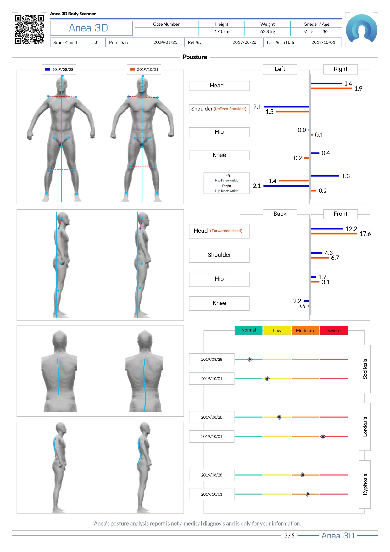 3d body scanner report Posture