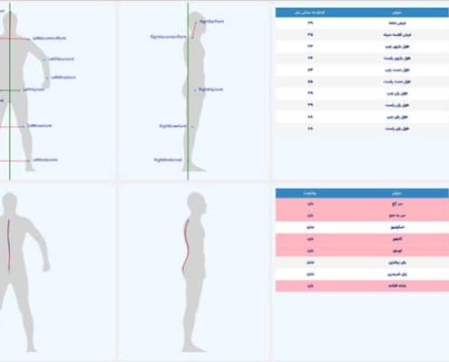 صفحه صفحه بررسی فرم اسکلتی و طول اندام‌ها در نرم‌افزار آنیا