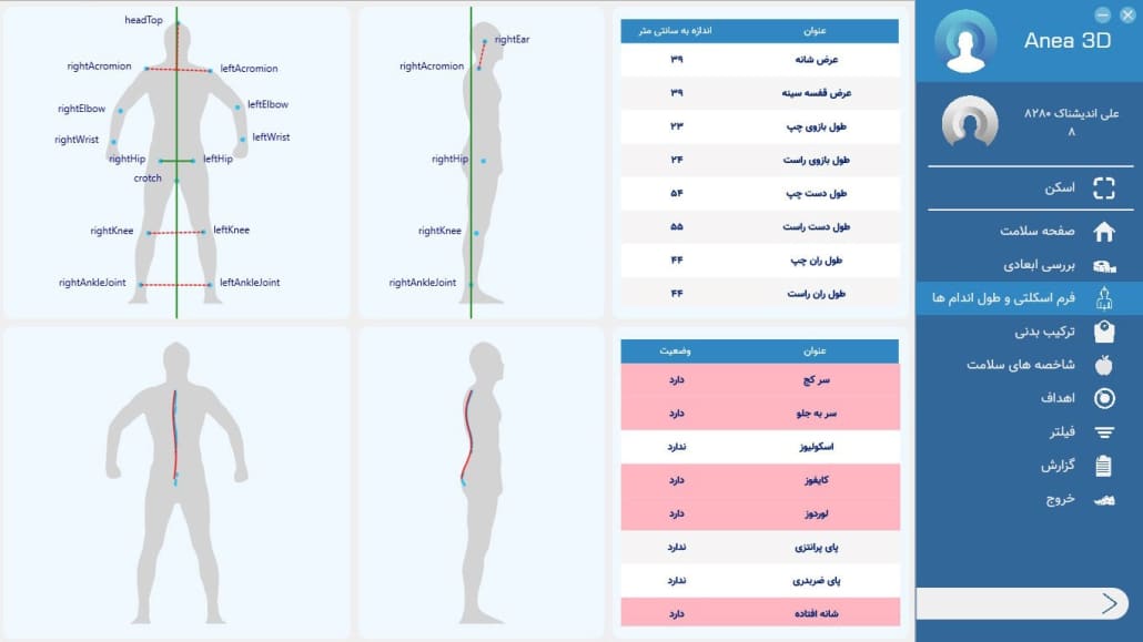 فرم اسکلتی