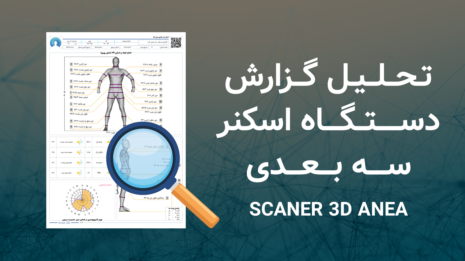 تحلیل گزارش اسکنر سه بعدی